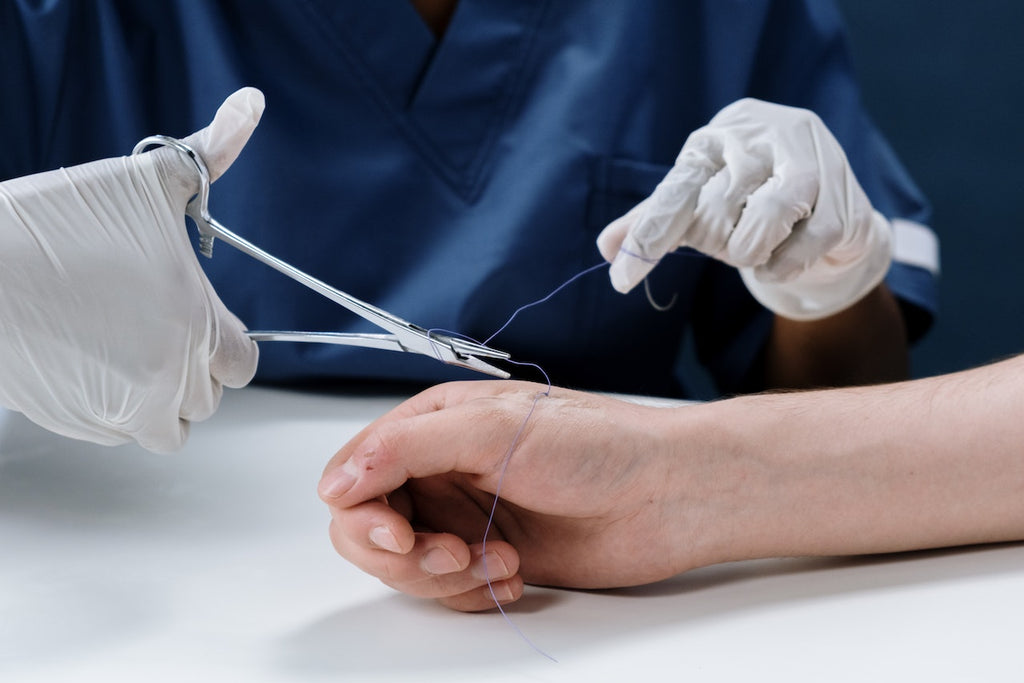 The Different Types of Surgical Sutures and How They Work