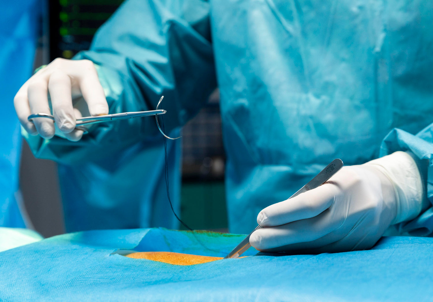 suture